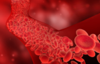 Aplicação da terapia CAR-T em tumores hematológicos